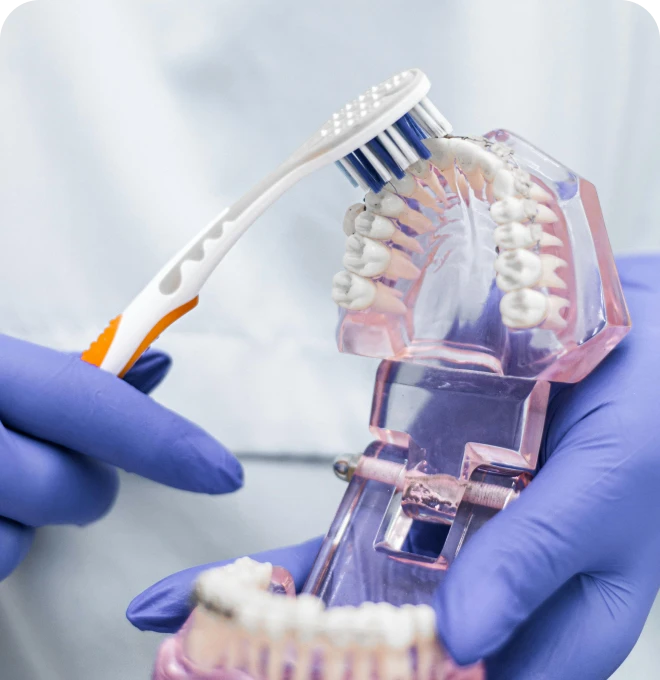 brossage orthodontie tahiti Hygiène bucco-dentaire Dr Isabelle Chartres, Orthodontiste Tahiti