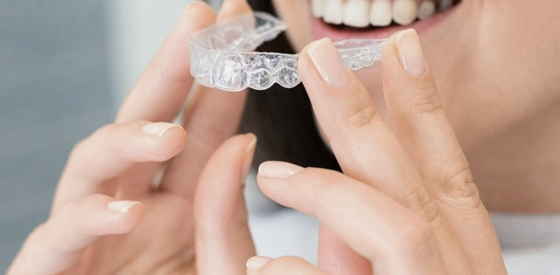 invisalign punaauia traitement ado Nos appareils Dr Isabelle Chartres, Orthodontiste Tahiti