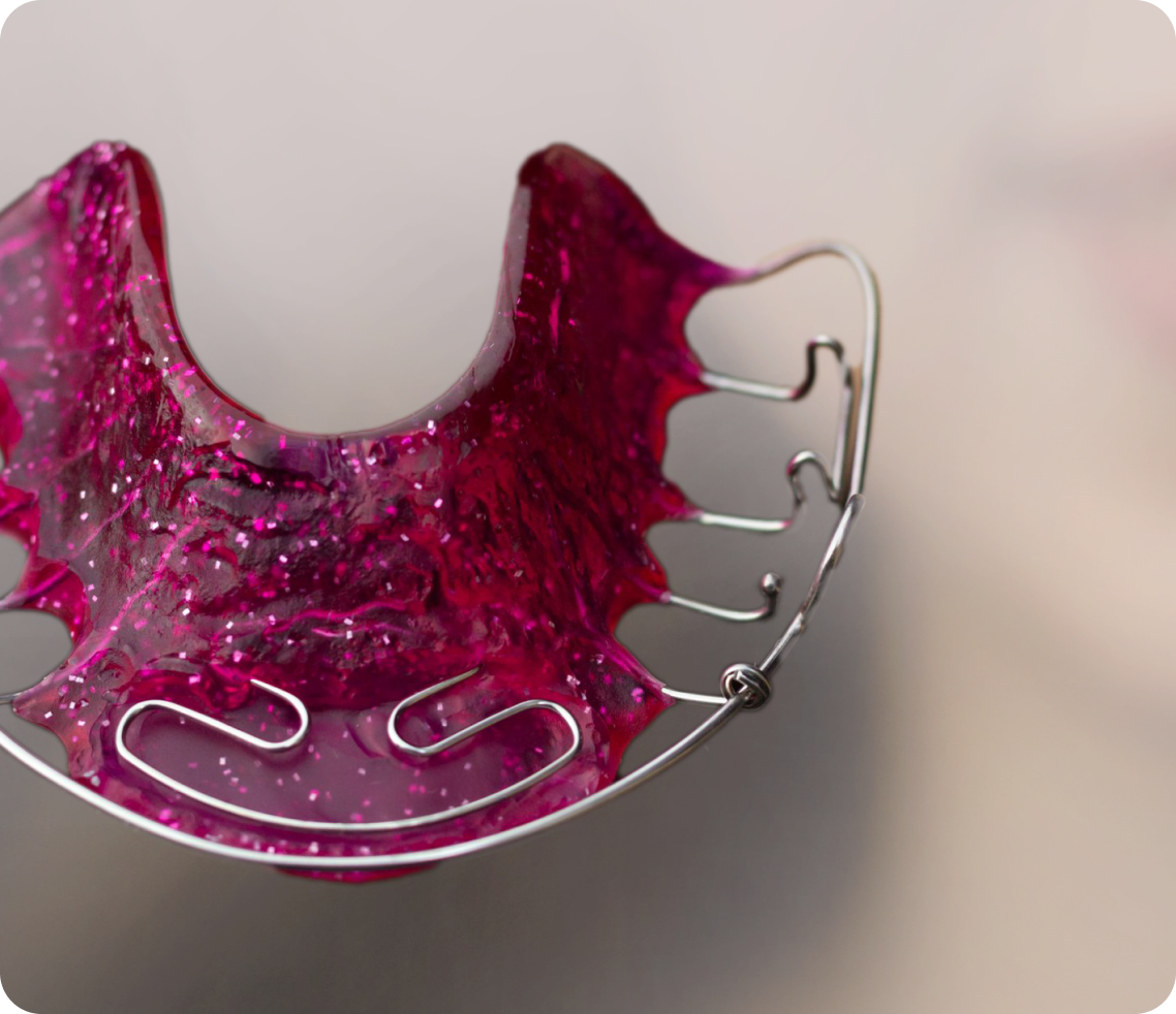 plaque palatine punaauia enfant Orthodontie précoce de nouvelle génération Dr Isabelle Chartres, Orthodontiste Tahiti
