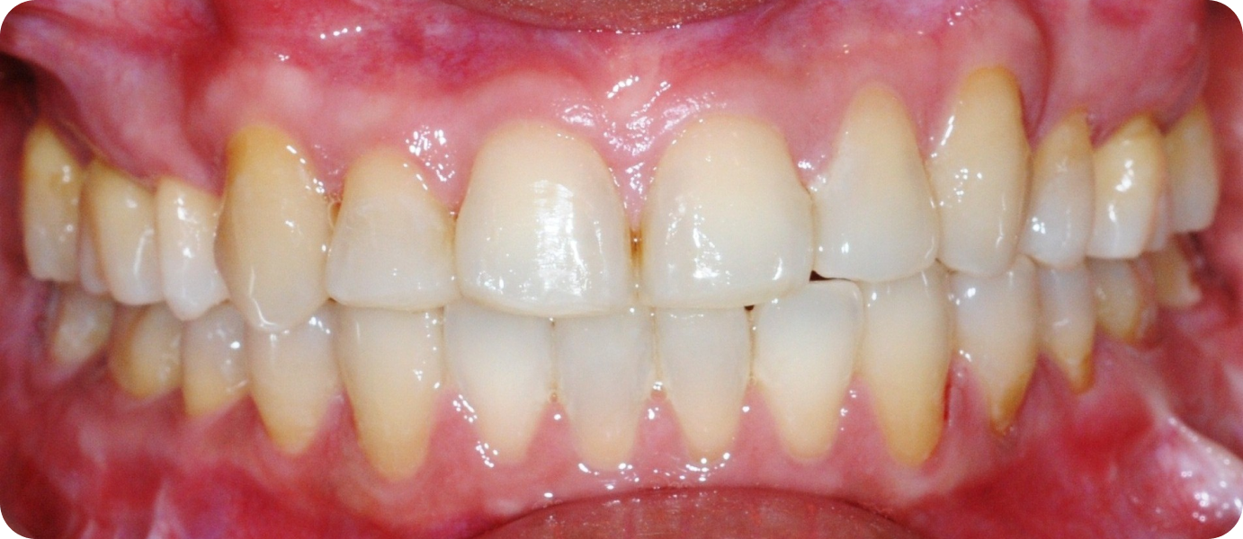 Dr Isabelle Chartres, Orthodontiste Tahiti