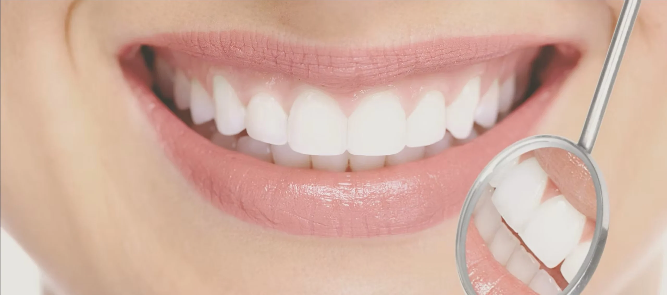 sourire aligne punaauia orthodontie scaled Notre cabinet Dr Isabelle Chartres, Orthodontiste Tahiti