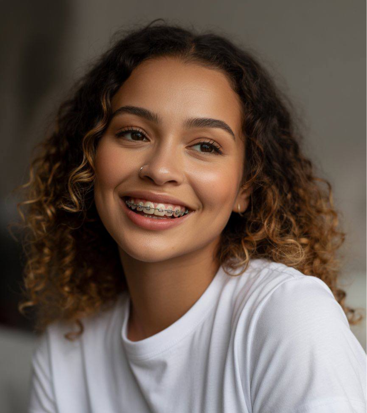 orthodontiste adulte punaauia alignement  Dr Isabelle Chartres, Orthodontiste Tahiti